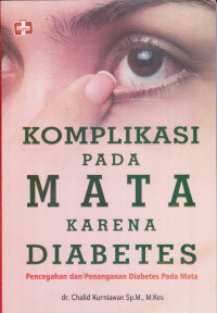 Komplikasi Pada Mata Karena Diabetes, Pencegahan Dan Penanganan Diabetes Pada Mata