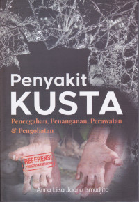 Penyakit Kusta, Pencegahan, Penanganan, Perawatan Dan Pengobatan