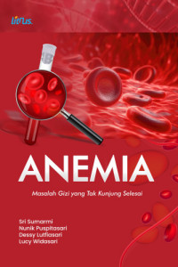 Anemia Masalah Gizi yang Tak Kunjung Selesai
