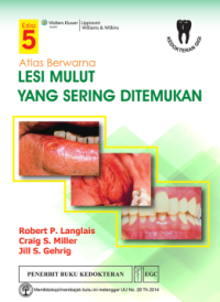 Image of Atlas Berwarna Lesi Mulut Yang Sering Ditemukan, Ed. 5