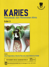 Karies Penyebab Dan Perawatan Klinis