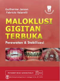 Image of Maloklusi Gigitan Terbuka Perawatan & Stabilisasi