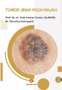 Image of TUMOR JINAK PADA WAJAH